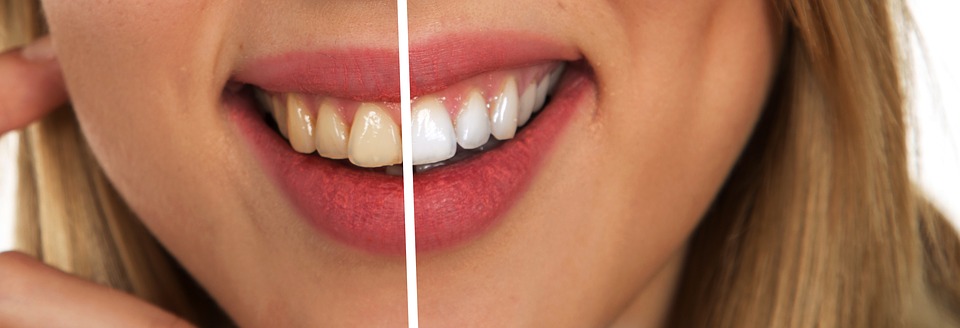 Benefits of Cosmetic Dentistry