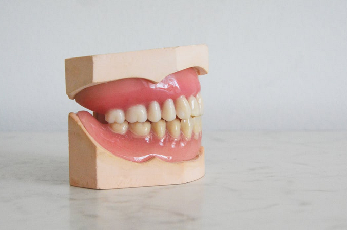 aligner